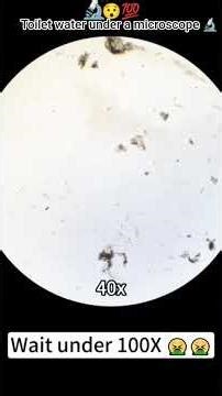 toilet 🚽 water under a microscope #shortvideo #viralvideo #doctor #video