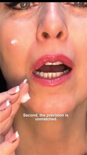 3 benefits of fibroblast technology