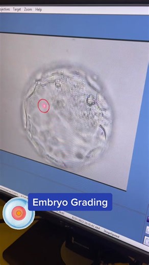 Embryo Grading: Understanding the Science Behind IVF Embryos