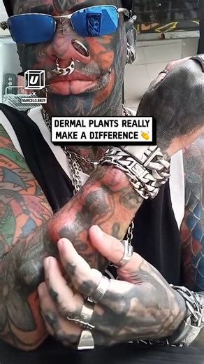 My dermal implants are wild 😏💪#guys #epic | UNILAD