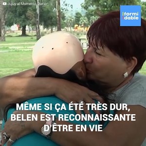 "J’avais 7 mois quand un incendie m’a brûlé 88% du corps”. Voici l’histoire de Belen, une jeune fille de 22 ans qui malgré la tragédie qu’elle a vécue, n’a jamais baissé les bras et se bat au jour le jour pour réaliser ses rêves. | Formidable