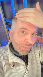 Autotrapianto capelli giorno 18 #autotrapianto #trapiantocapelli #capelli #hairstyle #claudioguerrini #Insparya Insparya | Claudio Guerrini