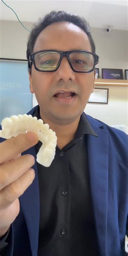 Quanto Custa Uma Prótese Dentária? Tudo Sobre o Preço