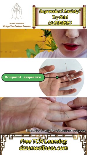 Depression? Anxiety? Try this to lift the spirits（心花怒放针法）