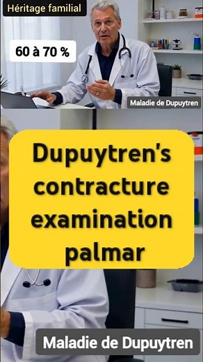 Steps Dupuytren's contracture examination palmar #Dupuytren #palmar #finger