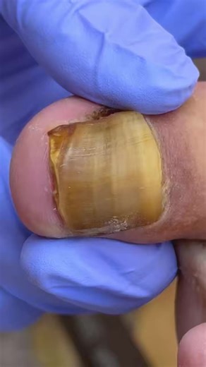 The moment we touched the nail everything changed 5BNM Beautiful moments of care and relaxation through a gentle pedicure experience. Simple, clean, and satisfying. 🌿✨ Disclaimer: This video is for educational and relaxation purposes only. All content belongs to the respective owners, no copyright infringement is intended. | Care ASMR