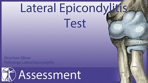 1.5K views · 33 reactions | ELBOW ASSESSMENT SERIES PART 14: MAUDSLEY'S TEST FOR TENNIS ELBOW / LATERAL EPICONDYLITIS The Maudsley's test, whose name we learned after we produced this video, assesses the involvement of the extensor digitorum longus in case of a tennis elbow. #Tenniselbow #elbowassessment | Physiotutors | Facebook