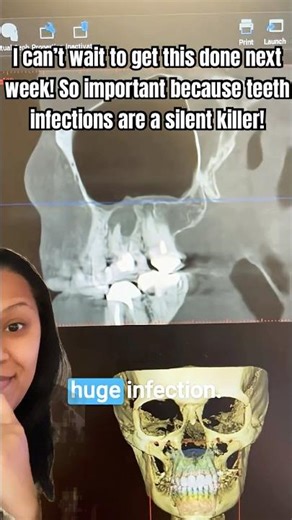 Have you had a cone beam scan?