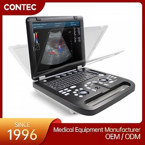 [Hot Item] Contec Cms1700c High Quality Diagnostic Ultrasonic Scanner Machine Color Doppler Ultrasound