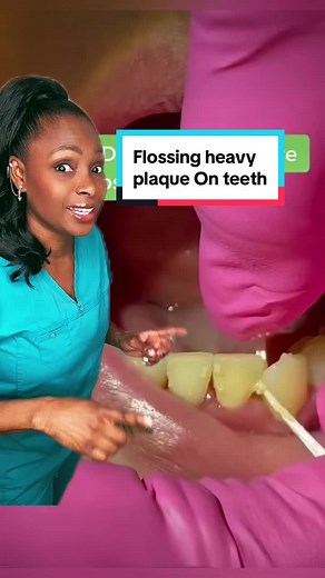 Effective Ways to Remove Plaque from Your Teeth