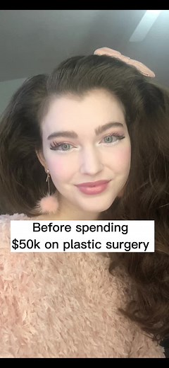 Plastic Surgery Glow Up: From Poor to Polished