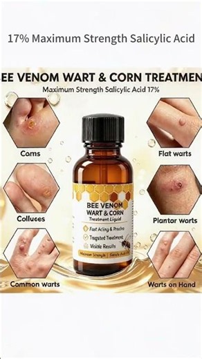 Wart Remover Liquid powered by 17% Salicylic Acid + 1% Bee Venom helps flat warts shed off naturally