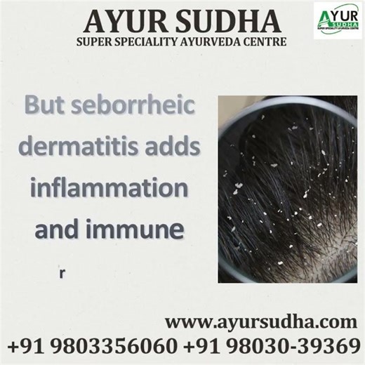 What causes seb. dermatitis & Dandruff?