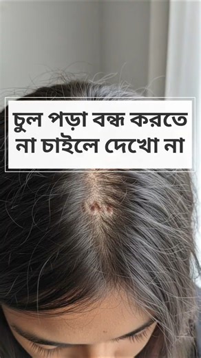“চুল পড়া বন্ধ করতে ৩ টি প্রমানিত ট্রিক!🥀#shorts