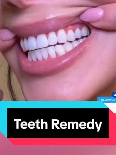 Whiten Your Teeth in 2 Minutes: Quick and Natural Tips
