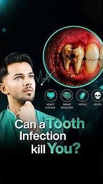 Can a Tooth Infection Actually Kill You? The Shocking Truth