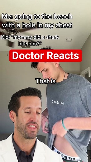 Understanding Pectus Excavatum: Symptoms and Treatment Explained