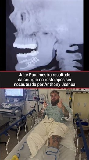 🔴🫂 ENFRENTOU PESO PESADO DE ELITE COMO UM GUERREIRO #Boxe #jackpaul #tysontigre gue