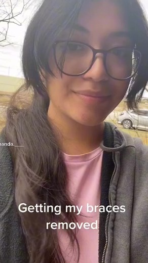 Girls Problems 🥺 #braces #bracesoff #bracesoffcheck #bracesoffcountdown #bracesgirl #bracescheck #bracestok #girlsproblems #braceslife #zahnspange #zahnspangenlife #zahnspangenfilter #zahnspangengirl #zahnspangen #zahnspangengang #mädchenprobleme #foryou #viral #fyp