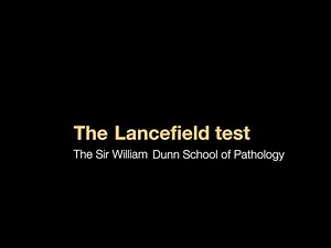 Lancefield test