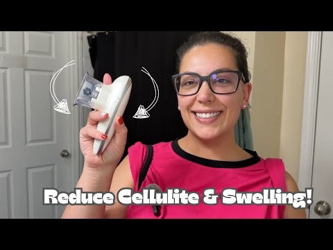 4-in-1 Electric Cellulite Massager Review | Body Sculpting Device for Belly, Thighs & Arms #ad