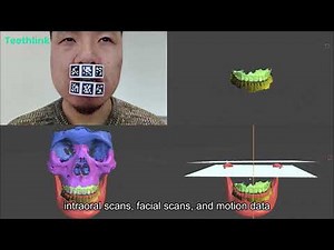 Teethlink AI Intelligent Electronic Facebow