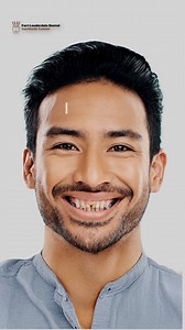 teeth clinic reel advertisment