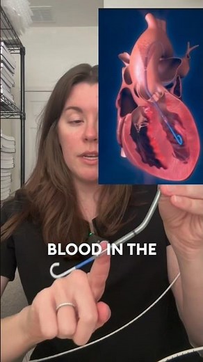 IMPELLA CP: How It WORKS! #tutorial #science #cathlab #impella