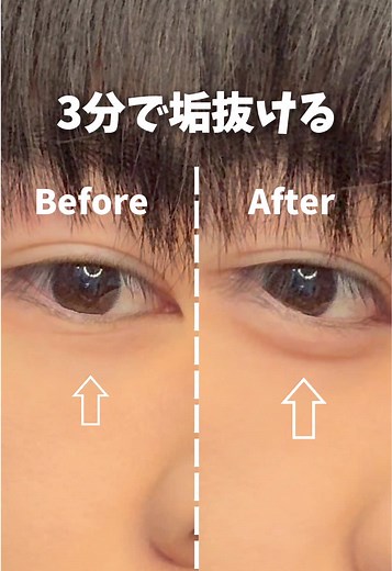 【保存必須】3分で垢抜ける涙袋の描き方!! メンズの涙袋はマジで差別化できるからやってみて！ #垢抜け #メンズメイク #メンズ美容 #fypシ