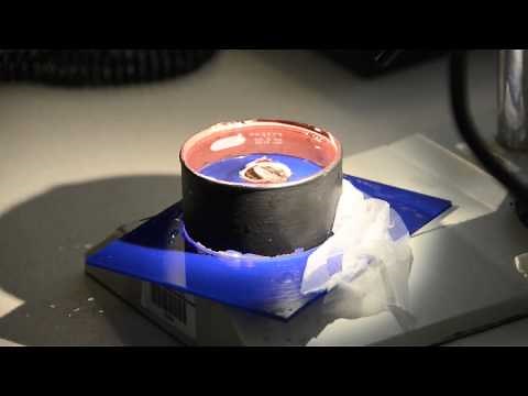 Wills Eye Hospital Pathology Department Gross Disection