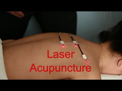 Laser Acupuncture