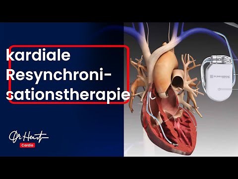Cardiac resynchronization therapy (CRT) – simply explained | Dr.Heart