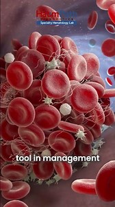 Thrombin Generation Assay (TGA) Explained | Advanced Coagulation Testing by Haempath Diagnostics