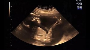 Today is four years since the abortion referendum. We will keep fighting for the lives of the most vulnerable among us. Join us: www.prolifecampaign.ie | Pro Life Campaign Ireland