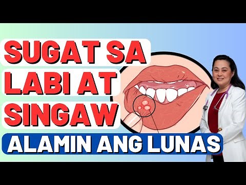 Sugat sa Labi at Singaw: Alamin ang Lunas. - Payo ni Doc Liza Ramoso-Ong
