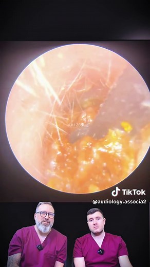 Understanding Blocked Ear Canals and Fluid Build-Up