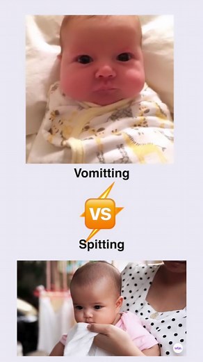 Dr Sumitra Meena | MD Pediatrician | Baby Sleep Expert on Instagram: "Spitting vs. Vomiting in Newborns New parents, do you know the difference? Understanding the reasons behind your baby's spit-ups can offer peace of mind. Here's a breakdown: Gastroesophageal Reflux: When stomach contents backtrack into the esophagus. It's a common cause for spits in infants. Overfeeding: Babies have tiny tummies! Overfeeding might lead to spit-ups. Food Sensitivities: Certain proteins in breast milk or formula