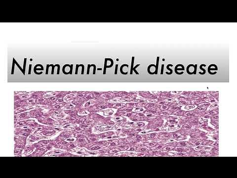 Niemann Pick Disease