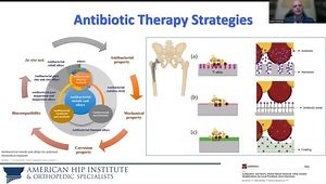 Total Hip Arthroplasty: The Latest and Greatest - From Minimally Invasive Surgery to Robotics