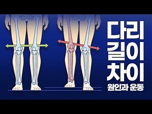 다리길이가 다르다고 느껴지세요? 틀어진 골반과 요추 비대칭이 원인!#다리길이교정, 다리비대칭교정