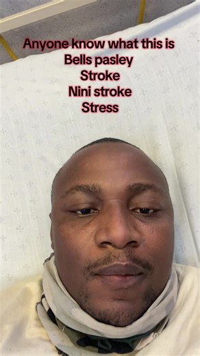 Understanding Bell's Palsy: Symptoms and Home Treatments