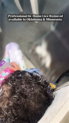 Pulling Out Lice and Nits You Can Actually See! 👀 #licetreatment