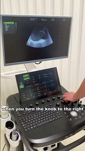Ultrasound Basics – How to Adjust Gain Properly #DaweiMedical #ultrasound #ultrasoundbasics