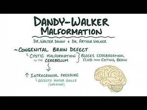 Dandy Walker Malformation ; congenital brain condition that affects the cerebellum