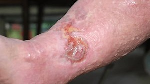 Herida en la pierna de mujeres: video de stock (totalmente libre de regalías) 1109862091 | Shutterstock