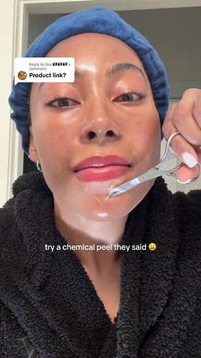 Perfect Image Revitaboost Peel Pads for Brown Skin - Day 4 Results