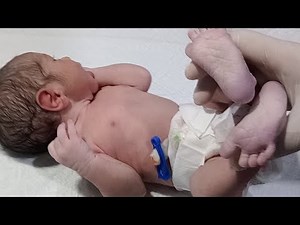 Newborn Baby Assessment | Head-to-Toe Examination | NICU Nurse Complete Guide