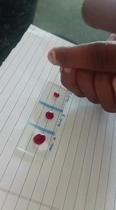 Blood group check practical