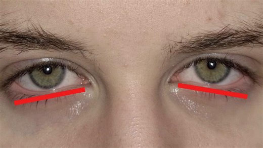 #creatorsearchinsights #eyearea #xybca #fyp #viral thanks for the follows and likes on the video before!