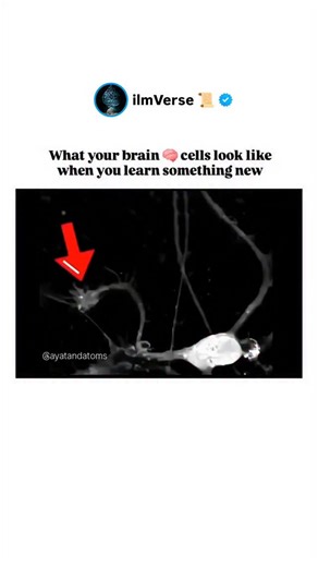 ilmVerse 📜 on Instagram: "✅ When we learn something new, our neurons (brain cells) actually change their connections and activity in a process called neuroplasticity. Here’s what happens step by step: 1. Activation of Neurons 🧠⚡ When you experience or practice something new, specific groups of neurons fire together in patterns. This repeated firing strengthens their link. 2. Synaptic Strengthening 🔗 The connections between neurons, called synapses, become stronger. This is often described by 